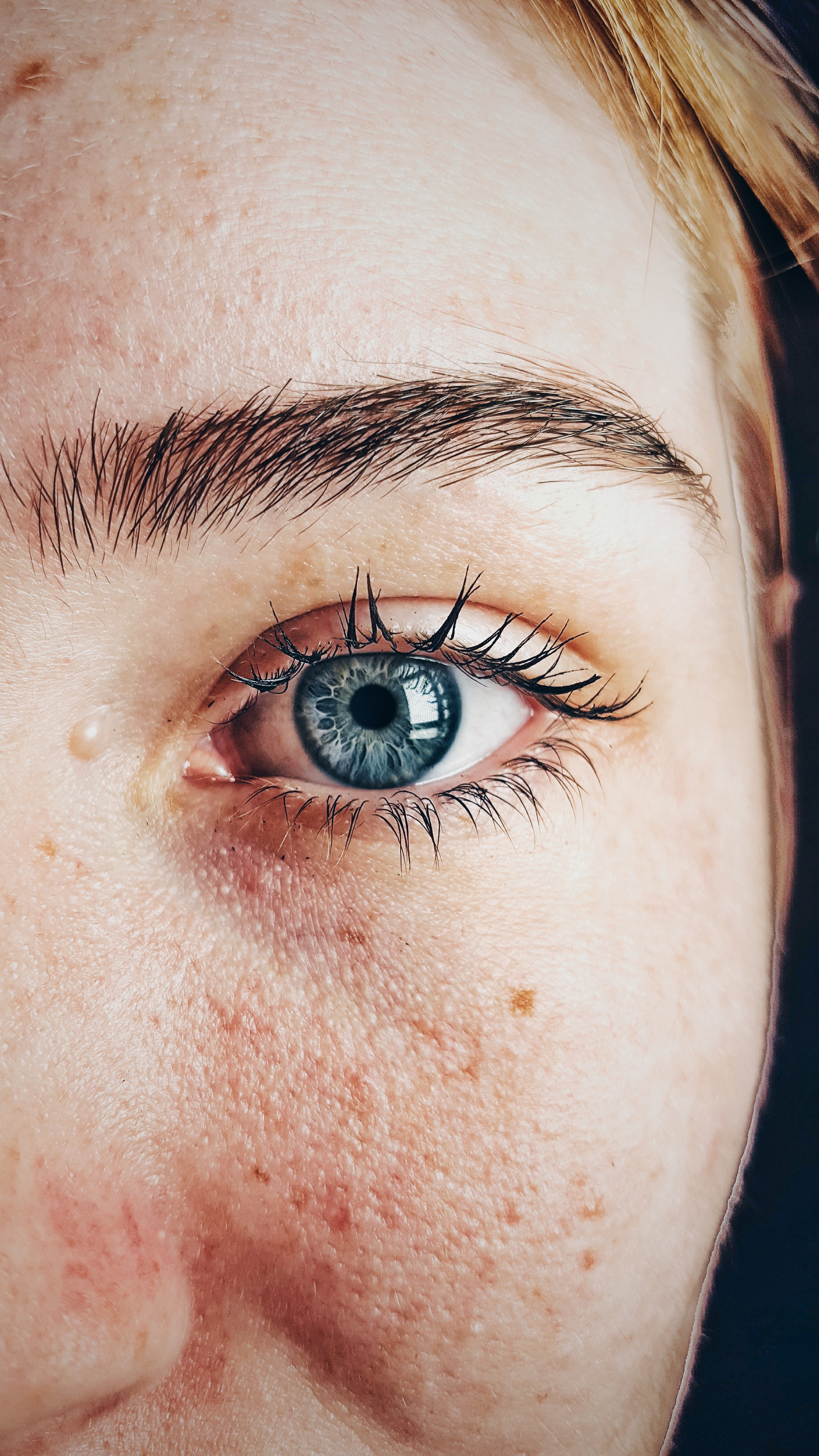 half face of a woman after using a bleach cream