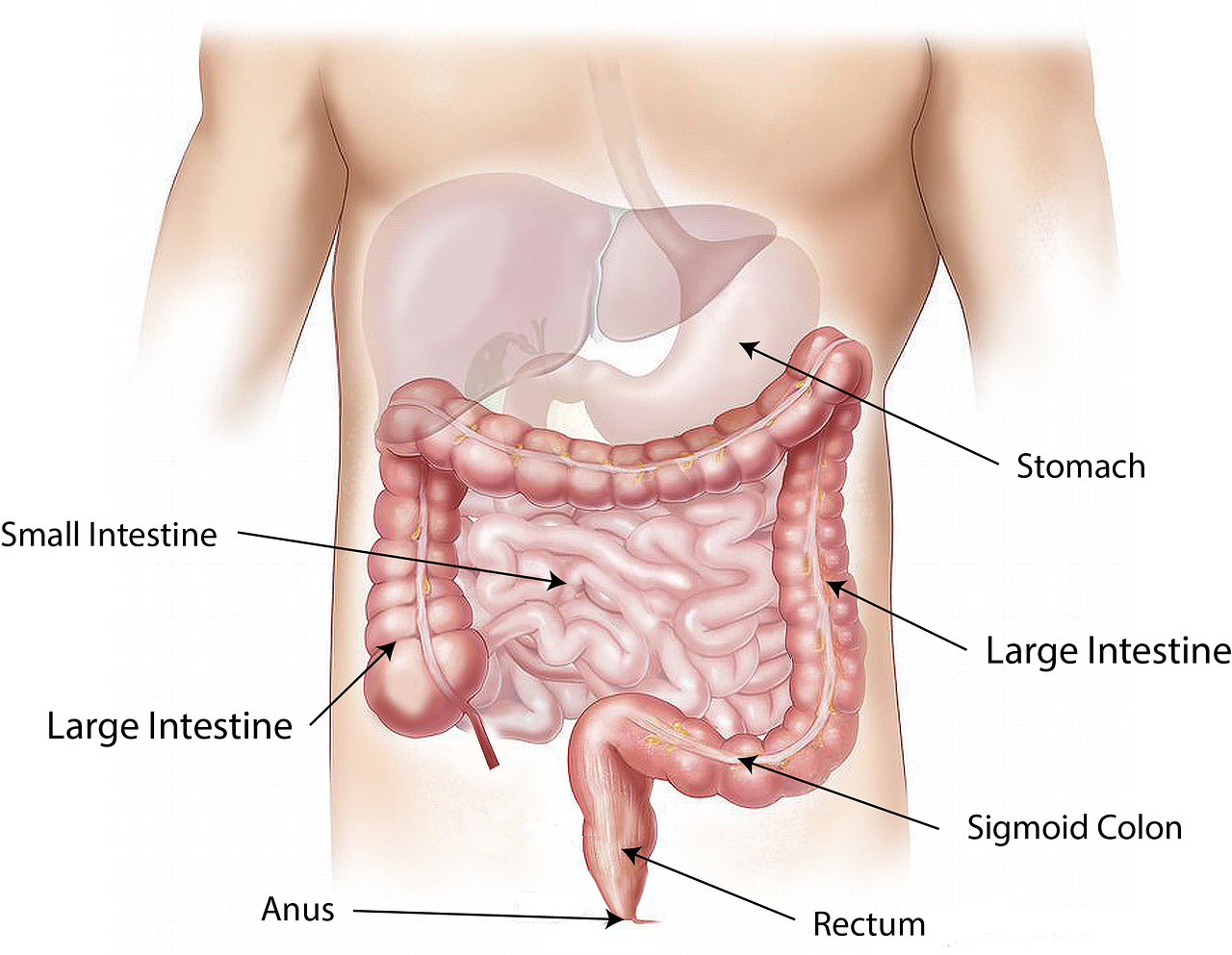 H pylori bacteria infections