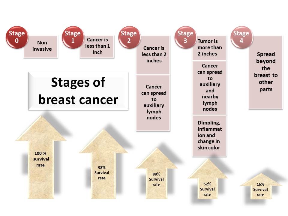 Breast cancer stages