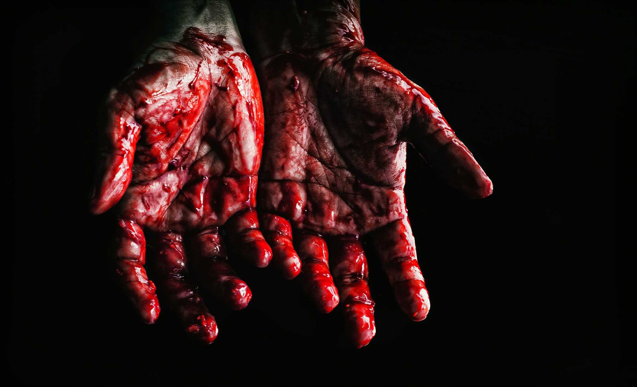 a bloody hand