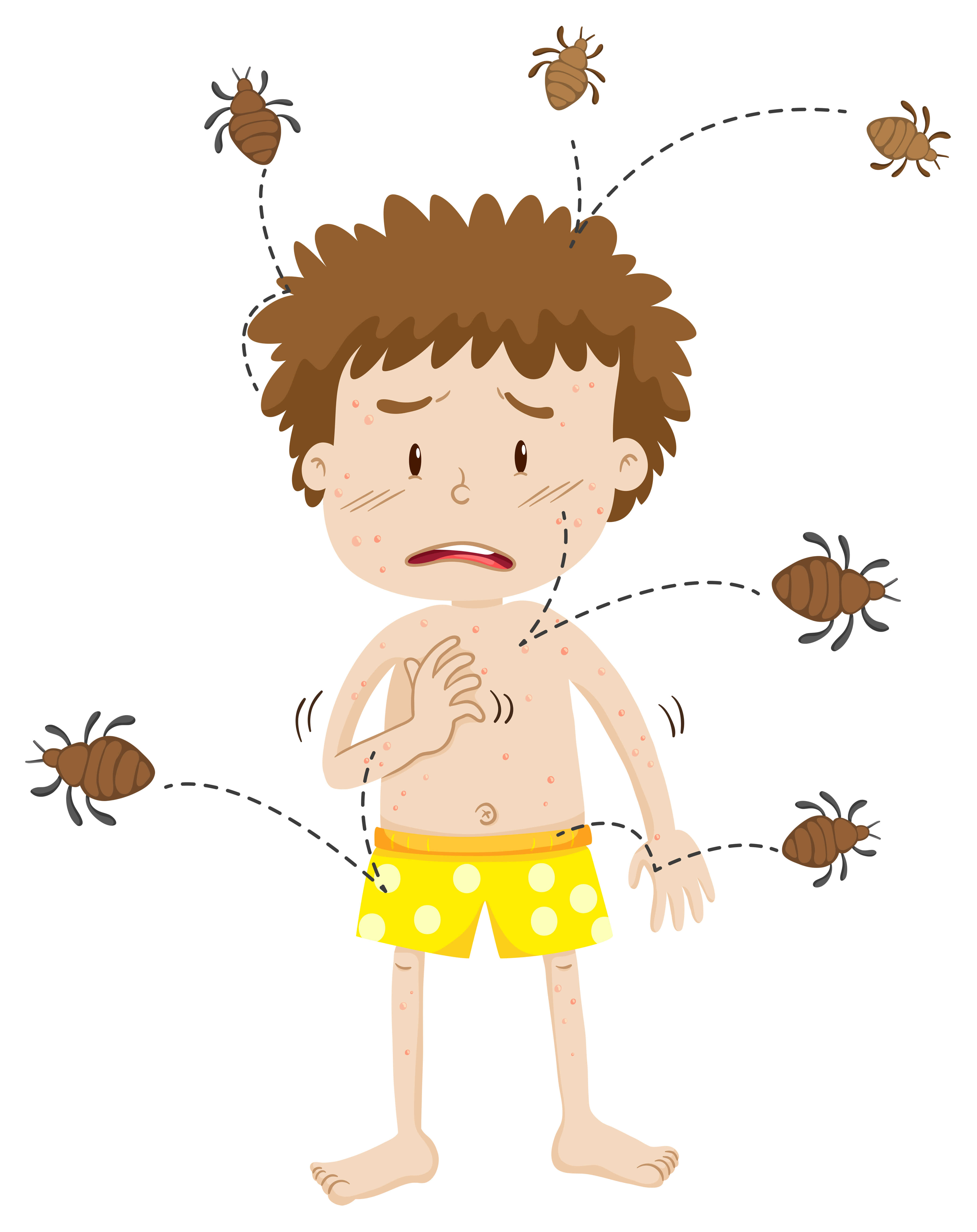 Home Remedies to get rid of bed bugs