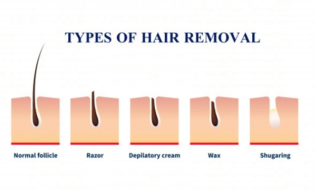 Hair Removal Products