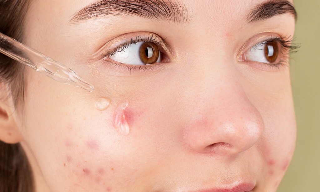 Home Remedies For Skin Cancer On Face | Pros And Cons