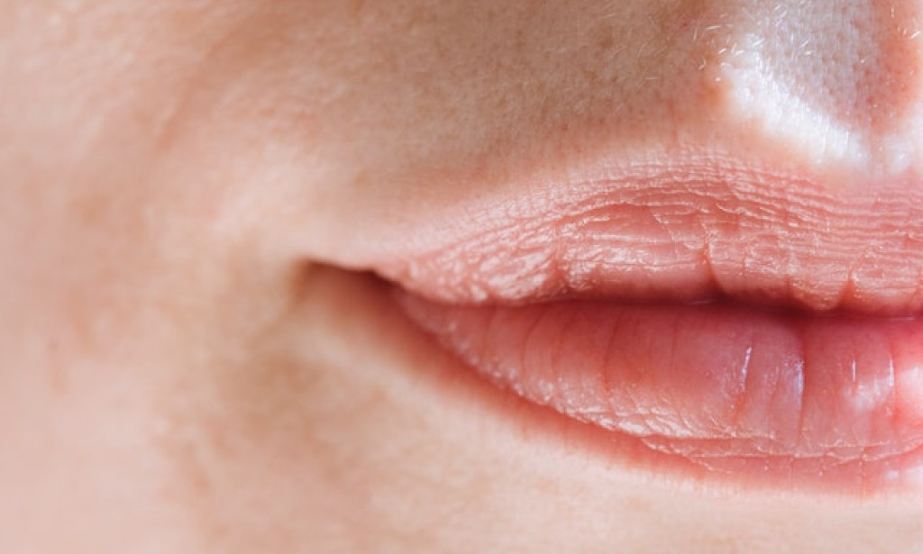 Home Remedies For Lip Sores I Your Ultimate Guide