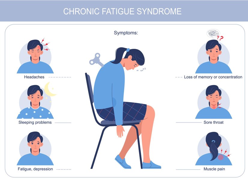 chronic fatigue treatment