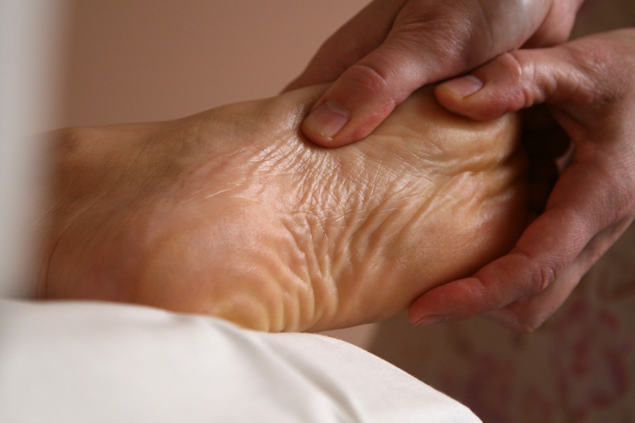 home remedies for cracked heels 